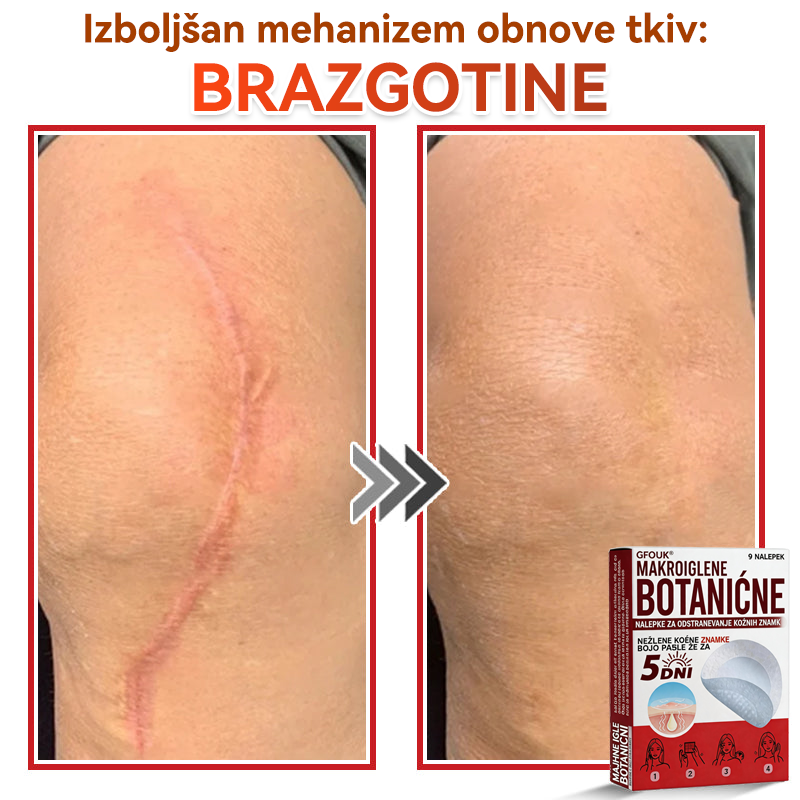 🗽✅GFOUK®Botanični obliž z mikroiglami za odstranjevanje kožnih izrastkov