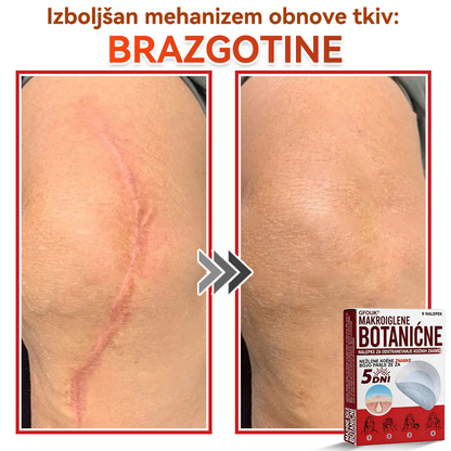 🗽✅GFOUK®Botanični obliž z mikroiglami za odstranjevanje kožnih izrastkov