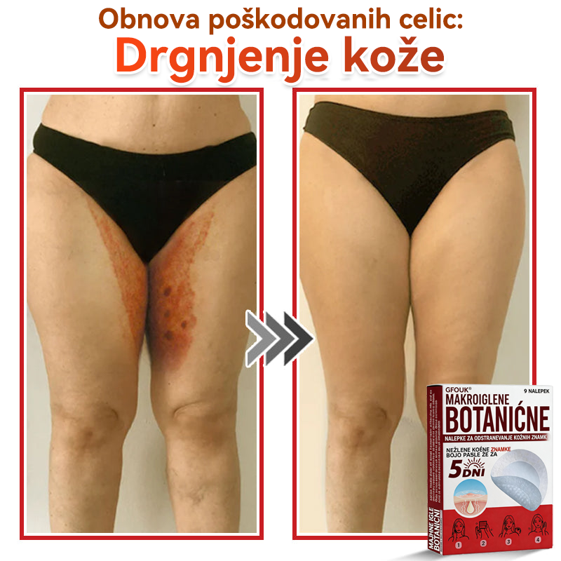 🗽✅GFOUK®Botanični obliž z mikroiglami za odstranjevanje kožnih izrastkov