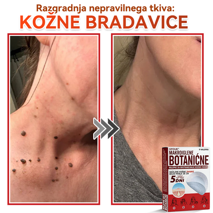 🗽✅GFOUK®Botanični obliž z mikroiglami za odstranjevanje kožnih izrastkov