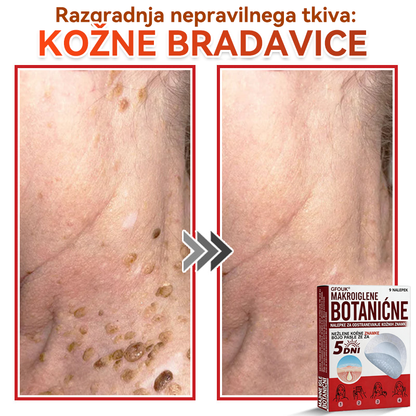 🗽✅GFOUK®Botanični obliž z mikroiglami za odstranjevanje kožnih izrastkov